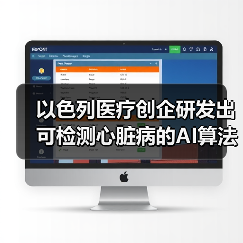 AI医疗影像分析革新冠状动脉疾病检测